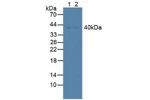 Western blot analysis of (1) Human K562 Cells and (2) Human Lung Tissue. (TNFRSF10B Antikörper  (AA 234-435))