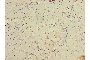 Immunohistochemistry of paraffin-embedded human colon tissue using ABIN7152486 at dilution of 1:100 (BTRC Antikörper  (AA 701-1000))
