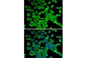 Immunofluorescence analysis of MCF7 cells using PARN antibody (ABIN6129553, ABIN6145230, ABIN6145231 and ABIN6222686). (PARN Antikörper  (AA 1-280))