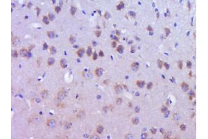 Paraformaldehyde-fixed, paraffin embedded Mouse brain Antigen retrieval by boiling in sodium citrate buffer (pH6. (DYNC1I2 Antikörper  (AA 61-160))