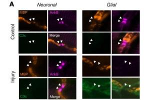 Immunostaining of ankyrin B (AnkB, magenta), MBP (orange), and C3c (green) in Neuronal and Glial injured mice in control and anti-GM1 treated groups.