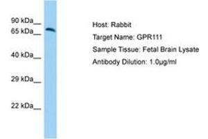 Image no. 1 for anti-G Protein-Coupled Receptor 111 (GPR111) (N-Term) antibody (ABIN6750187)