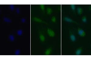 Detection of TGFb1 in Human U2OS cell using Polyclonal Antibody to Transforming Growth Factor Beta 1 (TGFb1) (TGFB1 Antikörper  (AA 279-390))