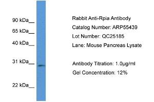 Western Blotting (WB) image for anti-Ribose 5-Phosphate Isomerase A (RPIA) (Middle Region) antibody (ABIN2786211) (Ribose 5-Phosphate Isomerase A (RPIA) (Middle Region) Antikörper)