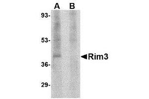 Image no. 1 for anti-Regulating Synaptic Membrane Exocytosis 3 (RIMS3) (N-Term) antibody (ABIN1495404) (RIMS3 Antikörper  (N-Term))