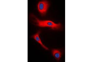 Immunofluorescent analysis of Glucagon staining in H9C2 cells. (Glucagon Antikörper  (Center))
