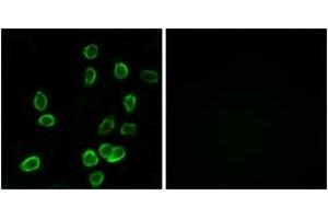 Immunofluorescence analysis of A549 cells, using ATP5G3 Antibody. (ATP5G3 Antikörper  (AA 1-50))