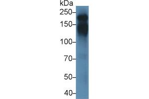 Detection of CD45 in Mouse Thymus lysate using Polyclonal Antibody to Protein Tyrosine Phosphatase Receptor Type C (CD45) (CD45 Antikörper  (AA 371-556))