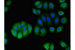 Immunofluorescent analysis of A549 cells using ABIN7170798 at dilution of 1:100 and Alexa Fluor 488-congugated AffiniPure Goat Anti-Rabbit IgG(H+L) (STOML1 Antikörper  (AA 79-290))