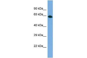 Western Blotting (WB) image for anti-KIAA1949 (KIAA1949) (C-Term) antibody (ABIN2784993)