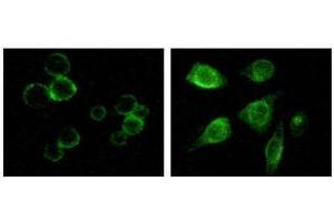 Immunofluorescence staining of methanol-fixed MCF-7 and HepG2 cells showing membrane and cytoplasmic localization. (TYRO3 Antikörper)