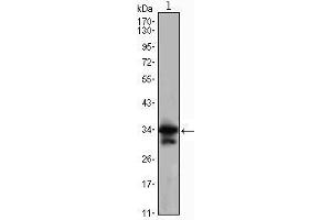 Western Blot showing CDC2 antibody used against Jurkat (1) cell lysate. (CDK1 Antikörper)