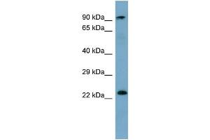 WB Suggested Anti-KRAS Antibody Titration: 0.