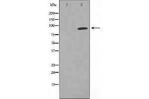 Western blot analysis on COLO cell lysate using CDK11 Antibody,The lane on the left is treated with the antigen-specific peptide. (CDK11 Antikörper  (Internal Region))