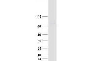 Western Blotting (WB) image for Ubiquitin Associated and SH3 Domain Containing, A (UBASH3A) (Transcript Variant 1) protein (Myc-DYKDDDDK Tag) (ABIN2734771)