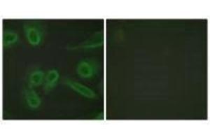 Immunofluorescence analysis of HeLa cells, using PECAM-1 (Ab-713) antibody. (CD31 Antikörper  (Tyr713))