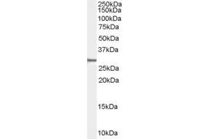 Western Blotting (WB) image for anti-Family with Sequence Similarity 107, Member B (FAM107B) (Middle Region) antibody (ABIN2774503) (FAM107B Antikörper  (Middle Region))