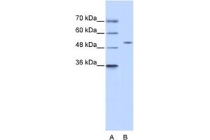WB Suggested Anti-ZNF555 Antibody Titration:  0. (ZNF555 Antikörper  (N-Term))