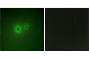 Immunofluorescence analysis of HuvEc cells, using LRAT Antibody. (LRAT Antikörper  (AA 111-160))