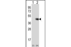 Western blot analysis of TPST1 (arrow) using rabbit polyclonal TPST1 Antibody  (ABIN650705 and ABIN2839242).