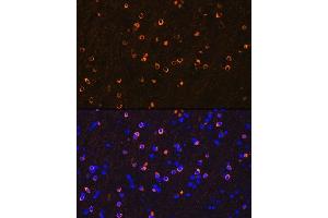 Immunofluorescence analysis of mouse brain using NMD Rabbit mAb (ABIN7267417) at dilution of 1:100 (40x lens). (GRIN1/NMDAR1 Antikörper)