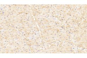 Detection of MYLK3 in Human Cardiac Muscle Tissue using Polyclonal Antibody to Myosin Light Chain Kinase 3 (MYLK3) (MYLK3 Antikörper  (AA 555-786))