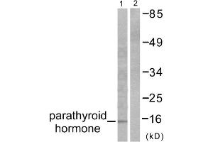 Western blot analysis of extracts from A549 cells, using Parathyroid Hormone antibody (ABIN5976482). (PTH Antikörper  (Internal Region))