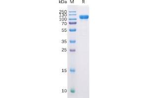 Human CD10 Protein, hFc Tag on SDS-PAGE under reducing condition. (MME Protein (Fc Tag))