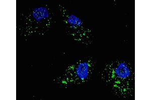 Fluorescent image of  cells stained with SQSTM1 (p62) (C-term) antibody. (SQSTM1 Antikörper  (AA 317-346))