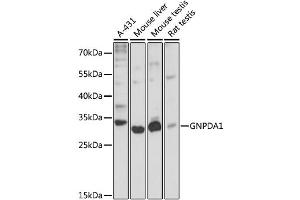 Western blot analysis of extracts of various cell lines, using GNPDA1 antibody (ABIN6292107) at 1:3000 dilution. (GNPDA1 Antikörper)