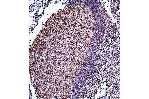 IHC analysis of PHF21A using anti-PHF21A antibody (ABIN6719353).