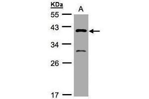 GIPC3 Antikörper  (N-Term)