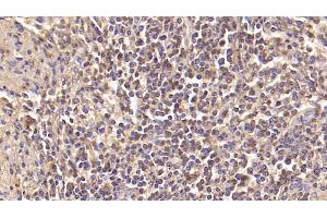 Immunohistochemistry (IHC) image for anti-Insulin Receptor (INSR) antibody (ABIN7427843)