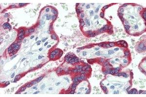 Detection of TFPI2 in Human Placenta Tissue using Polyclonal Antibody to Tissue Factor Pathway Inhibitor 2 (TFPI2) (TFPI2 Antikörper  (AA 23-235))