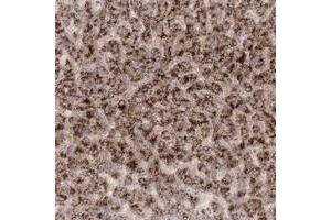 Immunohistochemical staining of human liver with TACC2 polyclonal antibody  shows strong cytoplasmic positivity in hepatocytes at 1:50-1:200 dilution. (TACC2 Antikörper)