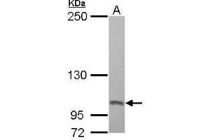 WB Image Sample (30 ug of whole cell lysate) A: A431 5% SDS PAGE antibody diluted at 1:500 (PSMD2 Antikörper)