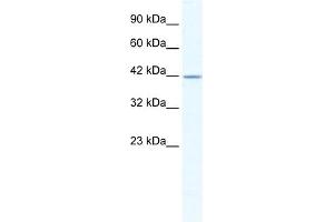 WB Suggested Anti-GABRA3 Antibody Titration:  2. (GABRA3 Antikörper  (Middle Region))