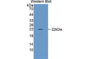 Western blot analysis of the recombinant protein. (TRPM7 Antikörper  (AA 19-179))