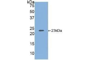 Detection of Recombinant HSPG, Human using Polyclonal Antibody to Heparan Sulfate Proteoglycan (HSPG)