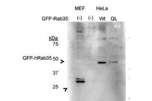 Human; RAB35 antibody - middle region validated by WB using HeLa cells, HEK293T cells at 1:500. (RAB35 Antikörper  (Middle Region))