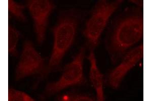 Immunofluorescence staining of methanol-fixed HeLa cells using CARM1 (Phospho-Ser228) antibody. (CARM1 Antikörper  (pSer228))
