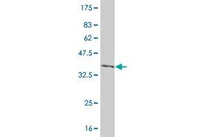 Western Blot detection against Immunogen (36. (IRAK2 Antikörper  (AA 111-210))