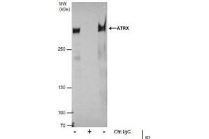 IP Image Immunoprecipitation of ATRX protein from 293T whole cell extracts using 5 μg of ATRX antibody [C3], C-term, Western blot analysis was performed using ATRX antibody [C3], C-term, EasyBlot anti-Rabbit IgG  was used as a secondary reagent. (ATRX Antikörper  (C-Term))