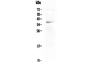 Western blot analysis of LOX-1/OLR1 using anti-LOX-1/OLR1 antibody . (OLR1 Antikörper  (Middle Region))