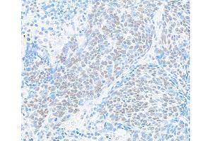 Immunohistochemistry (IHC) image for anti-Bromodomain Containing 9 (BRD9) (AA 547-597) antibody (ABIN7455162)