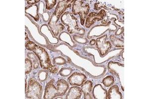 Immunohistochemical staining of human kidney with ZNF234 polyclonal antibody  shows strong cytoplasmic positivity in renal tubules. (ZNF226 Antikörper)