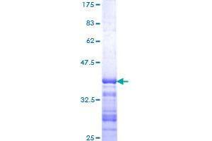 CARD11 Protein (AA 481-580) (GST tag)