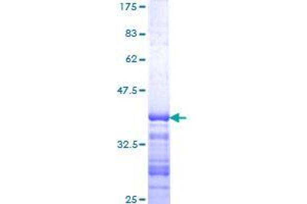 CARD11 Protein (AA 481-580) (GST tag)