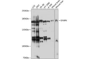 Western blot analysis of extracts of various cell lines, using SYMPK antibody (ABIN6128787, ABIN6148761, ABIN6148762 and ABIN6224767) at 1:1000 dilution. (Symplekin Antikörper  (AA 310-530))