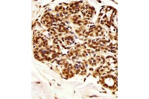 Immunohistochemical analysis of paraffin-embedded H. (PIN1 Antikörper)